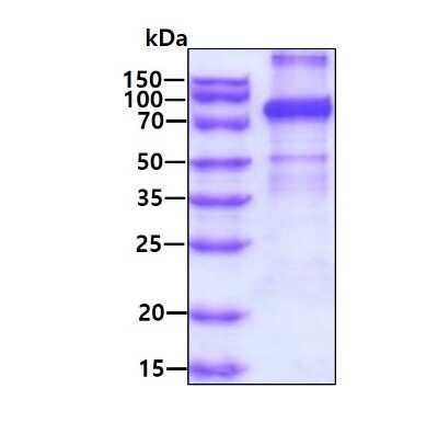 SDS-PAGE: Recombinant Human TARS His Protein [NBP1-99100]